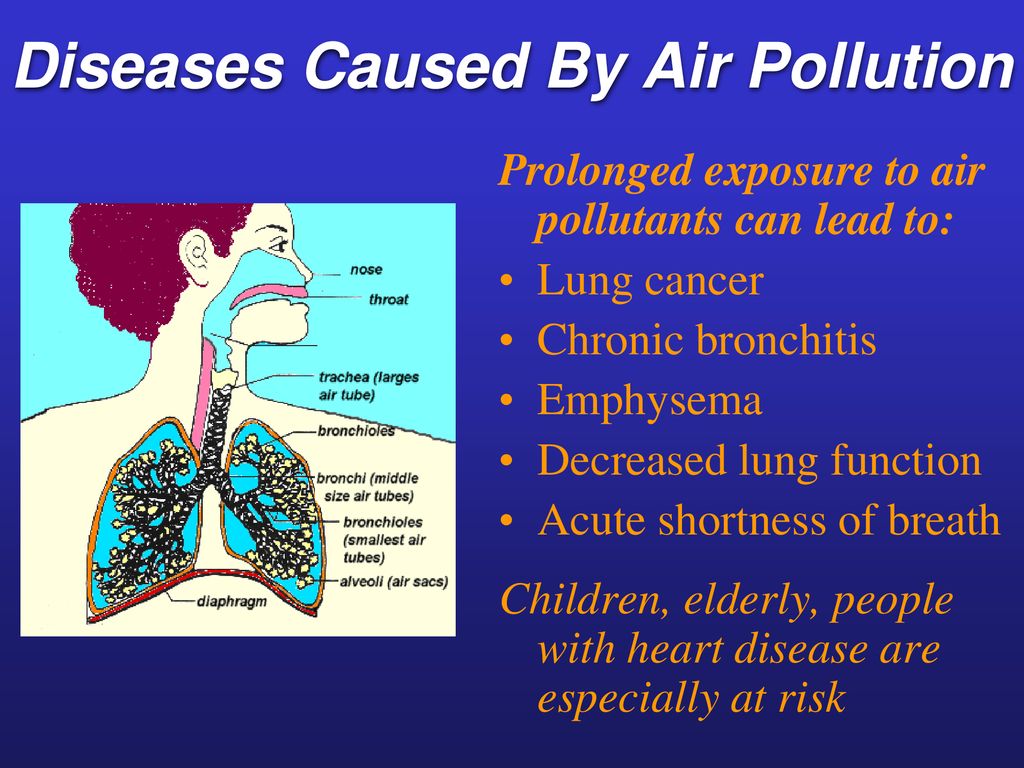 Cause to happen. Diseases caused by Air pollution. Air pollution diseases. Causes of Air pollution. Air pollution causes diseases.