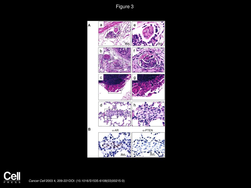 Figure 3 Homozygous Pten deletion leads to metastatic prostate cancer