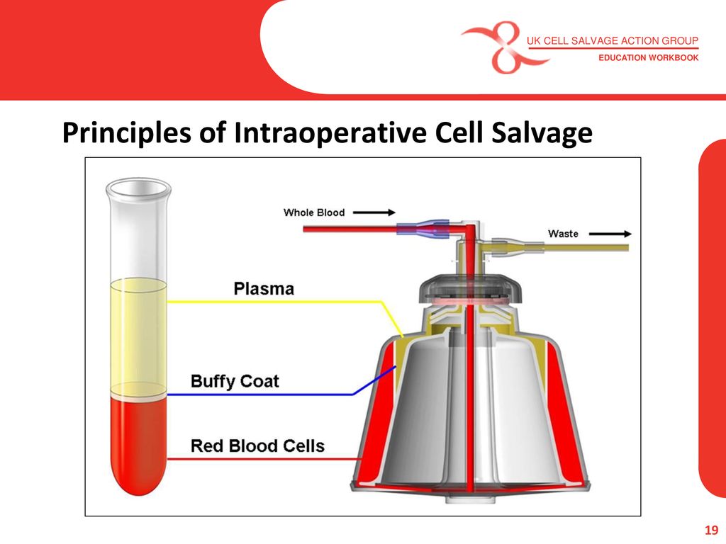 Intraoperative Cell Salvage Ppt Download