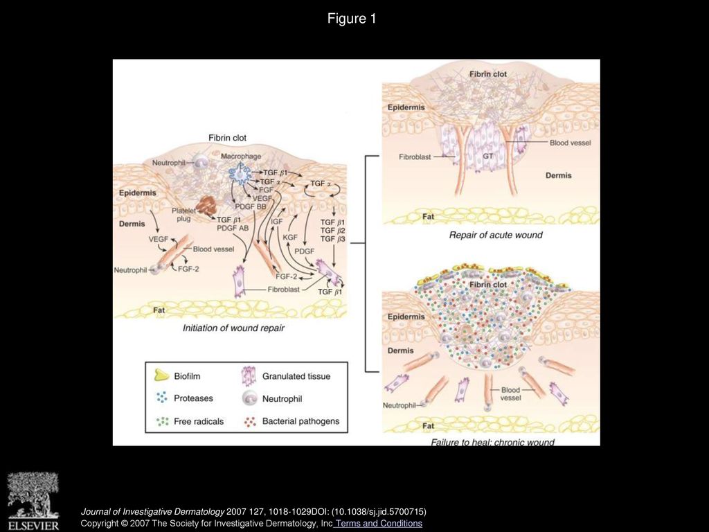 Tissue Engineering for Cutaneous Wounds - ppt download