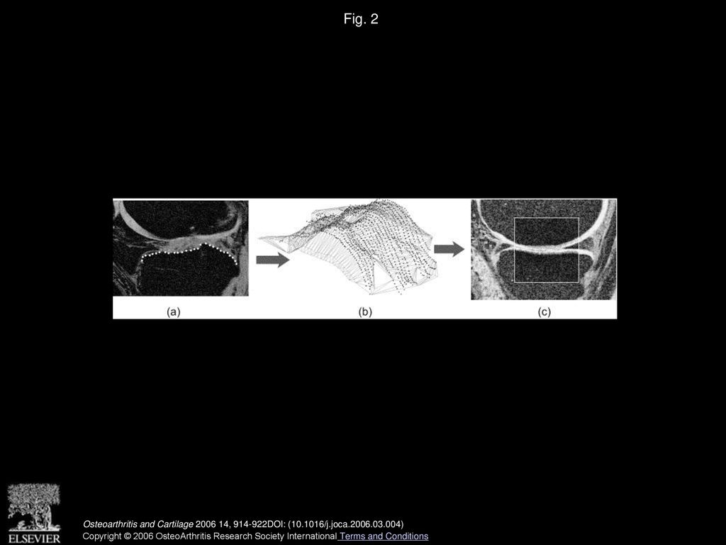 Reliability Of An Efficient Mri Based Method For Estimation Of Knee