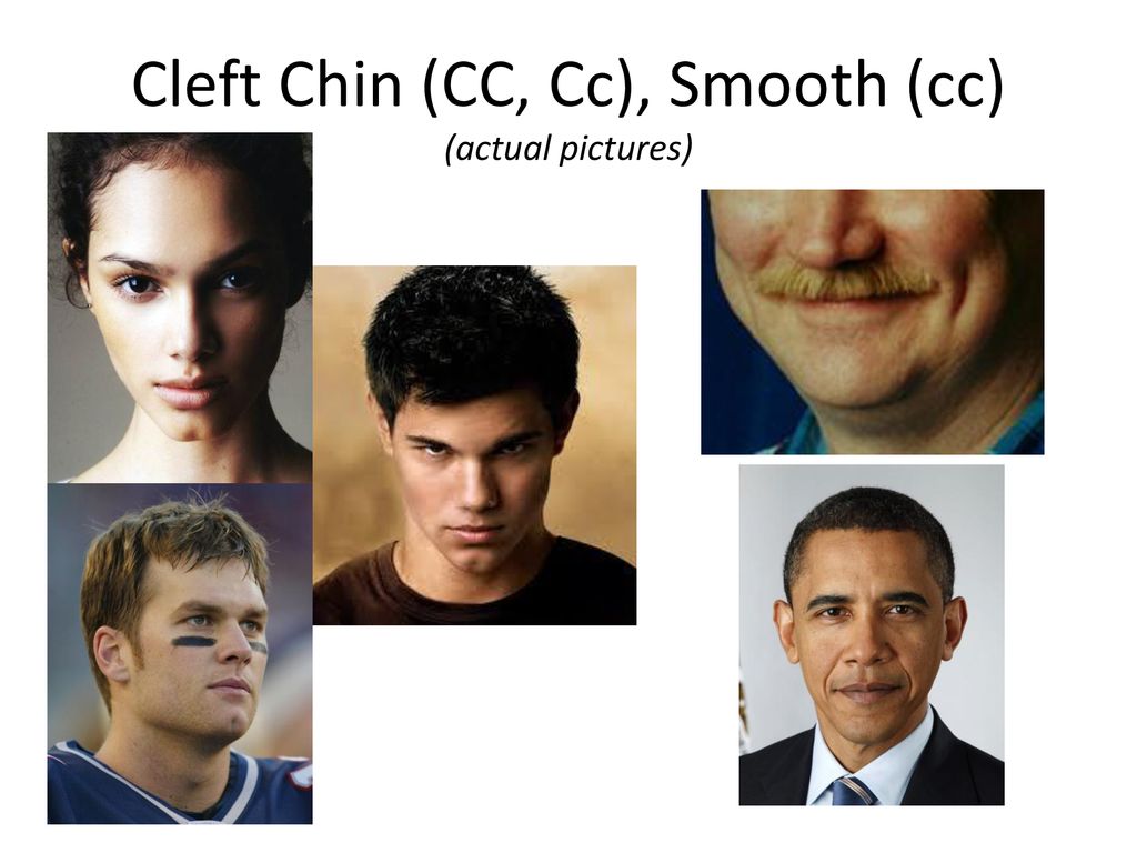 cleft-chin-surgery