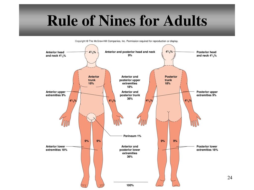 Rule of Nines for Adults