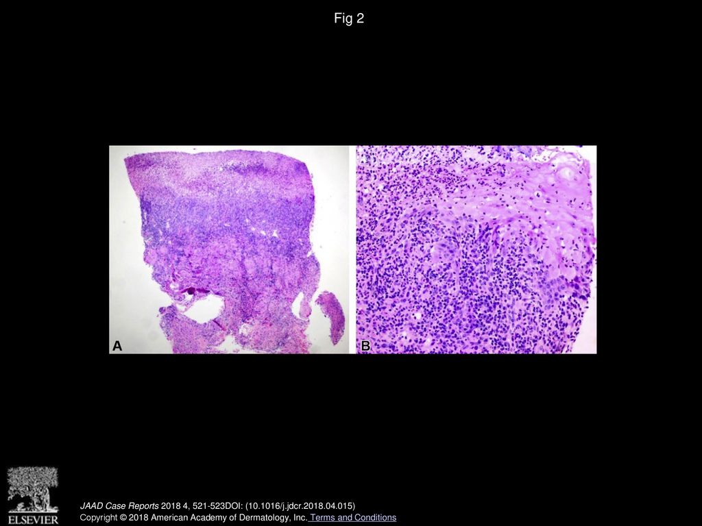 Volume 4, Issue 6, Pages (July 2018) - ppt download