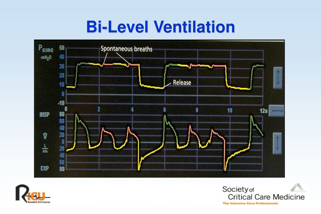 Advanced Mechanical Ventilation - ppt download