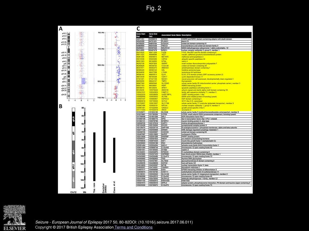 De novo 12q22.q23.3 duplication associated with temporal lobe epilepsy ...