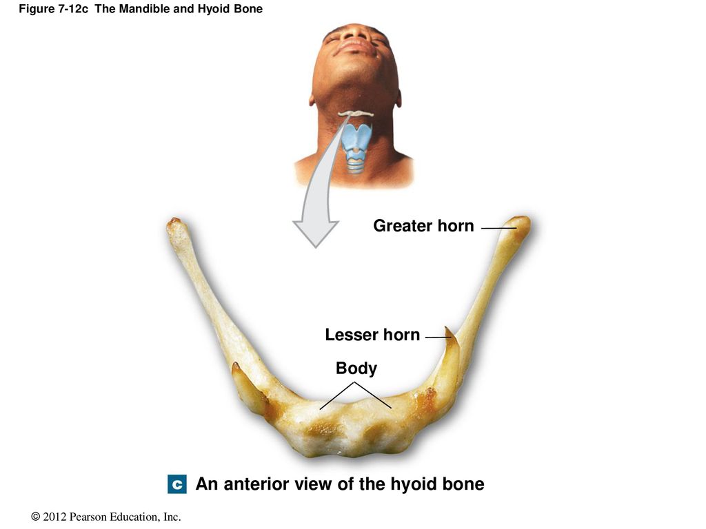 Figure 7-12c The Mandible and Hyoid Bone