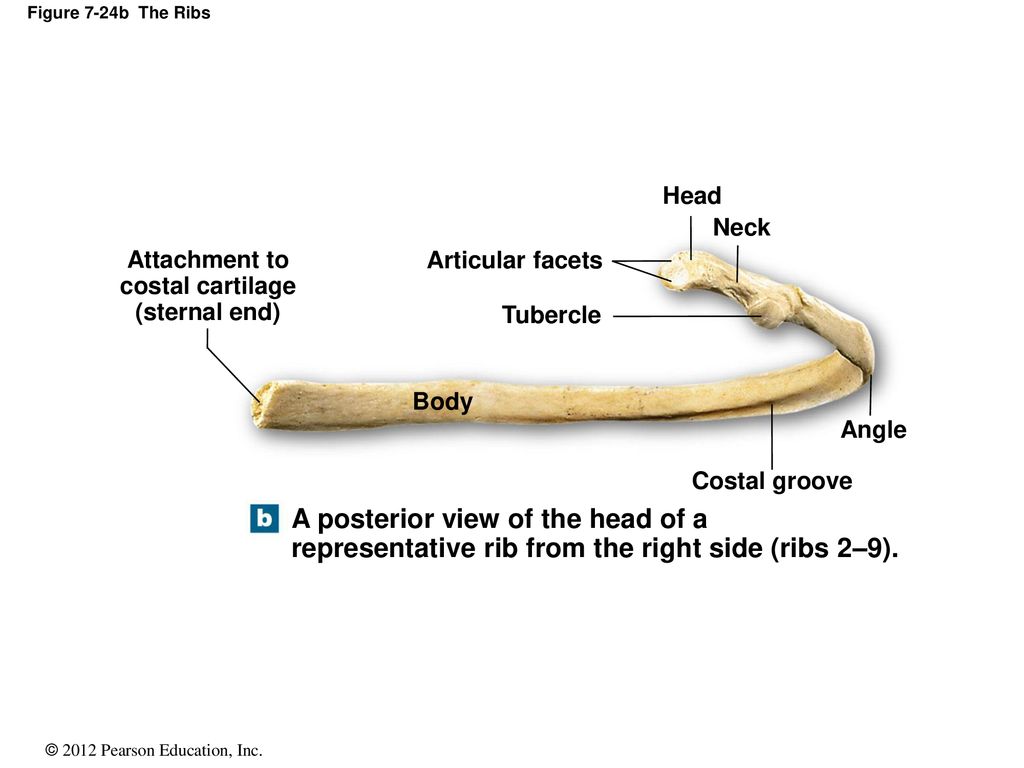 A posterior view of the head of a