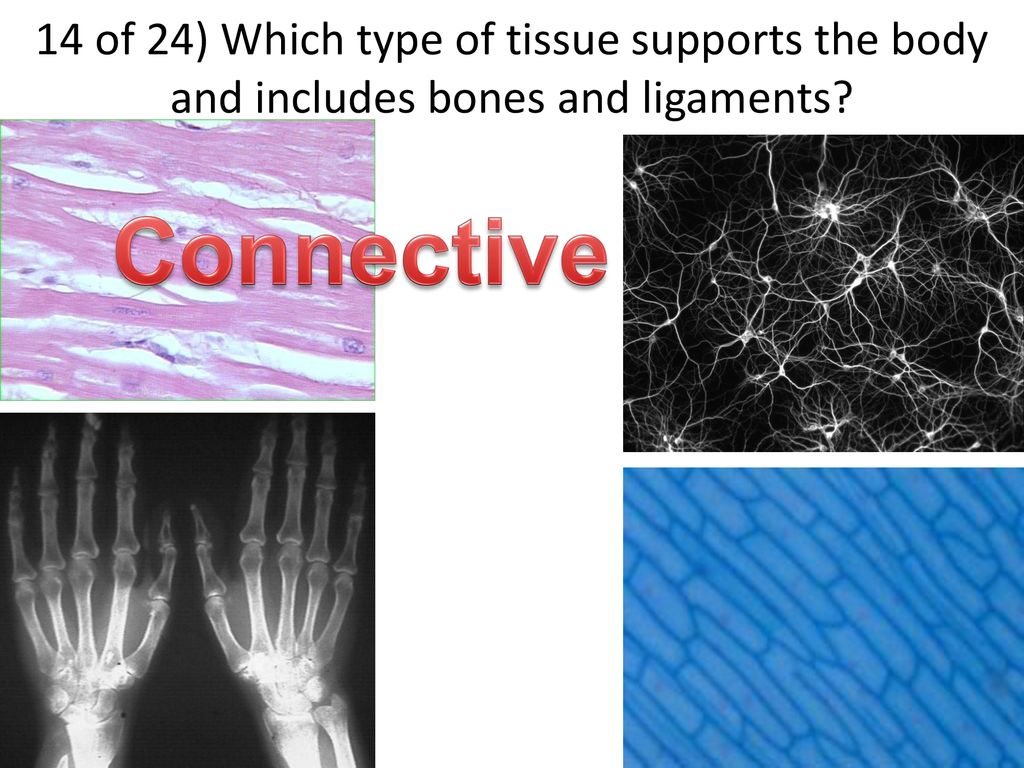 14 of 24) Which type of tissue supports the body and includes bones and ligaments