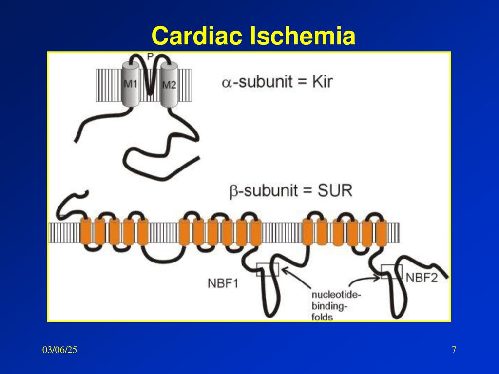 Cardiac Ischemia 03/06/25 1