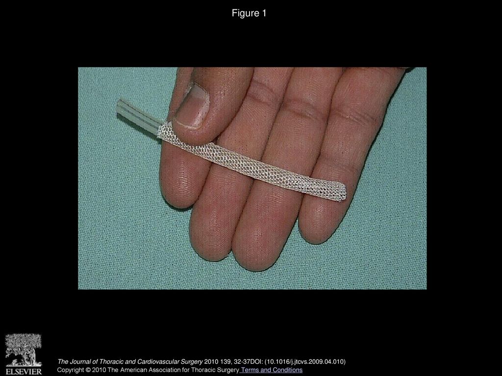 Figure 1 Mesh and Silastic (Dow Corning, Midland, Mich) tube before subcutaneus insertion on the backs of the donor animals.