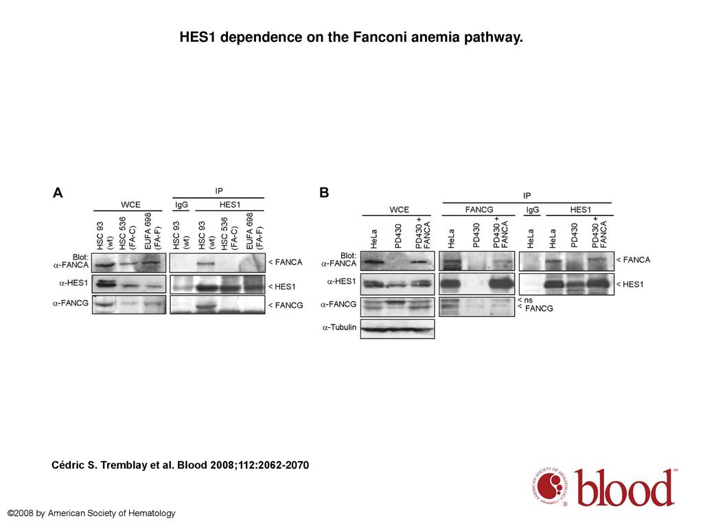 HES1 dependence on the Fanconi anemia pathway.