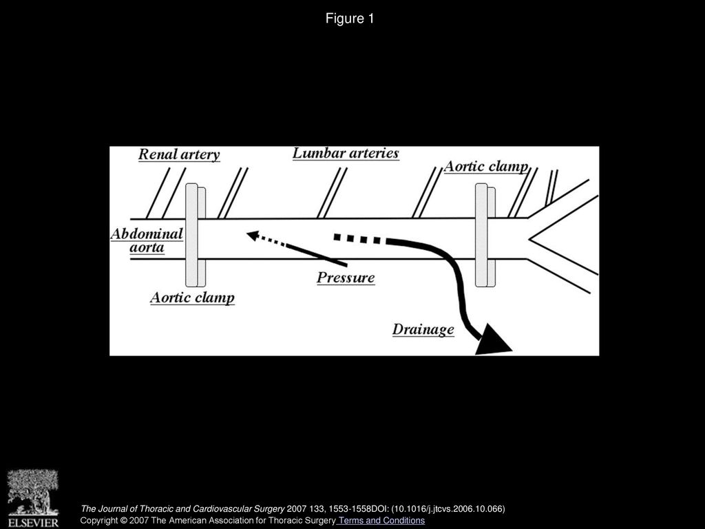 Figure 1 Schematic representation of the animal model for spinal cord ischemia with back-bleeding from lumbar arteries (group 1).