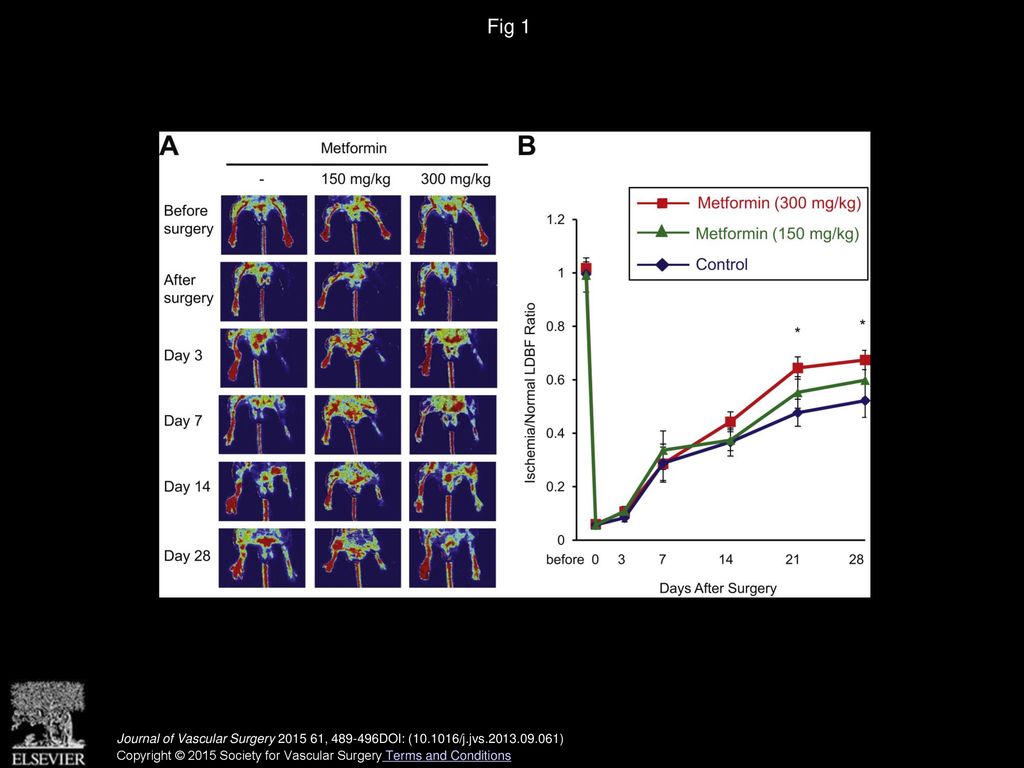 Metformin stimulates ischemia induced revascularization through an enos