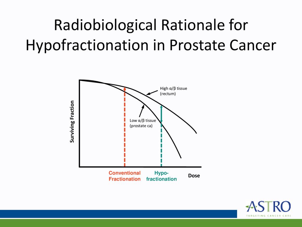 Hypofractionated Radiation Therapy For Localized Prostate Cancer An Astro Asco And Aua 6556