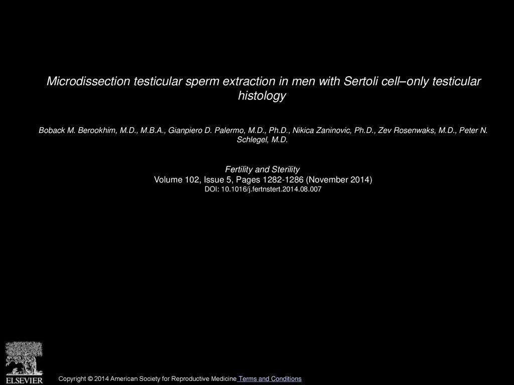 Microdissection testicular sperm extraction in men with Sertoli cell–only testicular histology