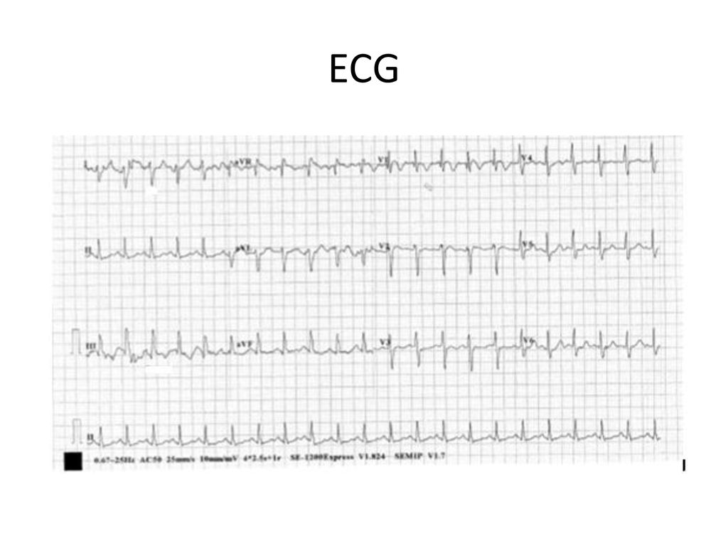 JCM OSCE Questions AHNH AED 2/1/ ppt download