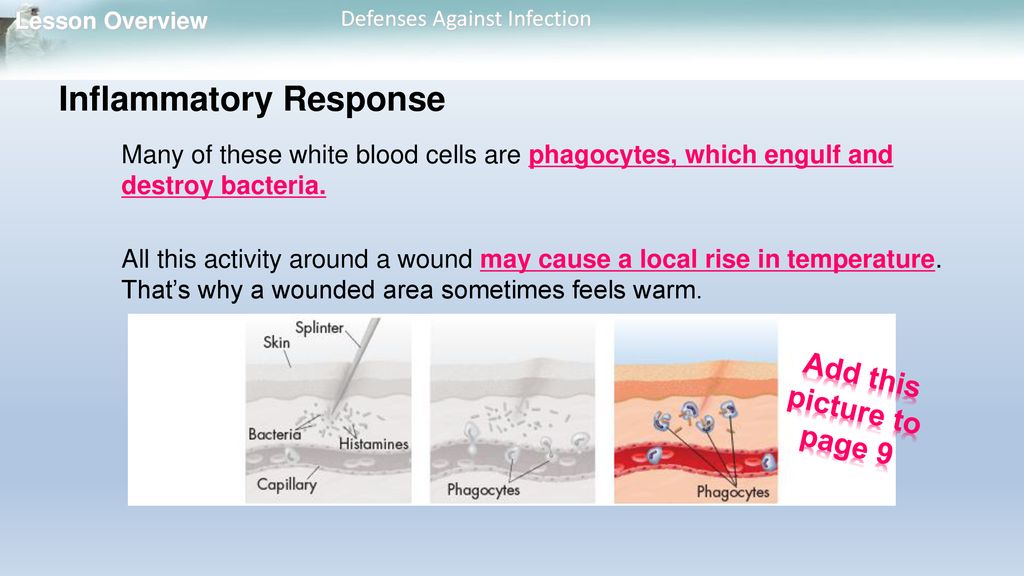 Lesson Overview 35.1 Infectious Diseases Biology Diagrams