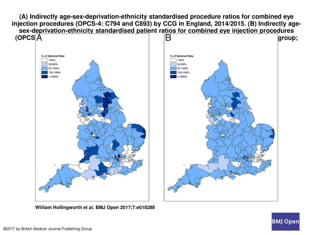 A Indirectly Age Sex Deprivation Ethnicity Standardised Procedure Ratios For Combined Eye