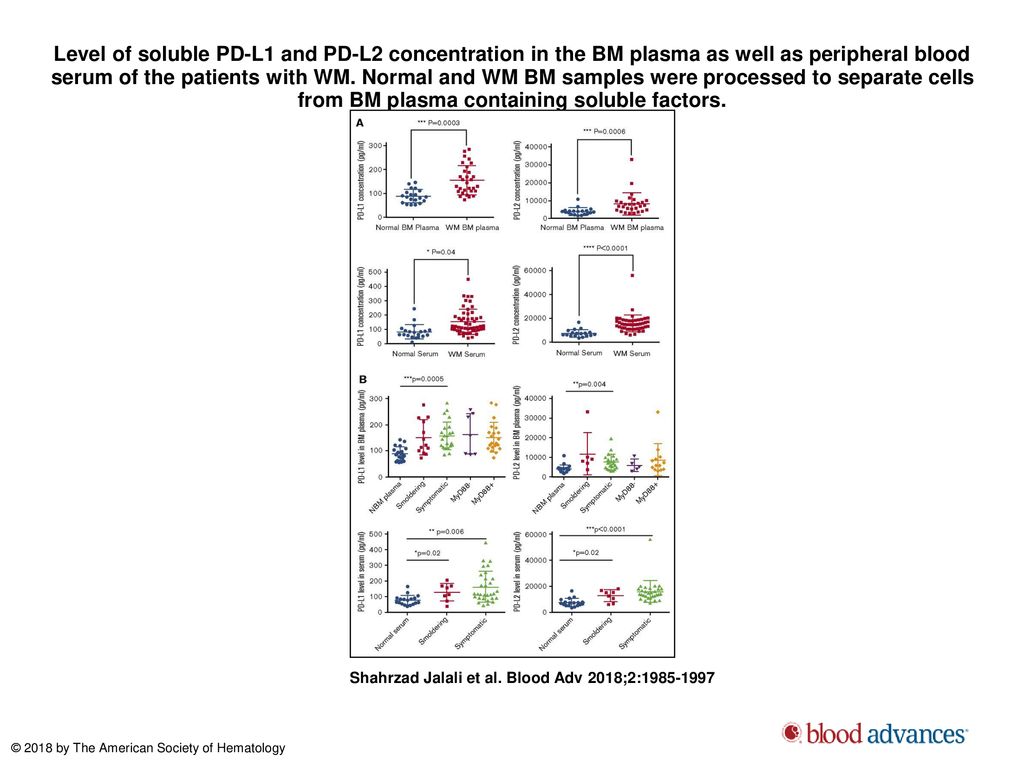 Level of soluble PD-L1 and PD-L2 concentration in the BM plasma as well as peripheral blood serum of the patients with WM. Normal and WM BM samples were processed to separate cells from BM plasma containing soluble factors.