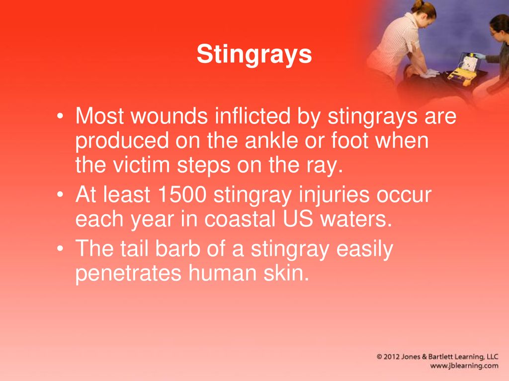 Stingrays Most wounds inflicted by stingrays are produced on the ankle or foot when the victim steps on the ray.