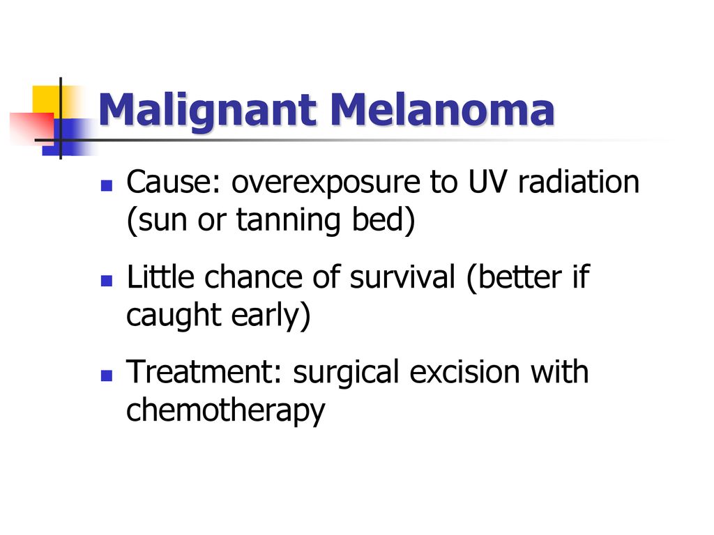 Malignant Melanoma Cause: overexposure to UV radiation (sun or tanning bed) Little chance of survival (better if caught early)