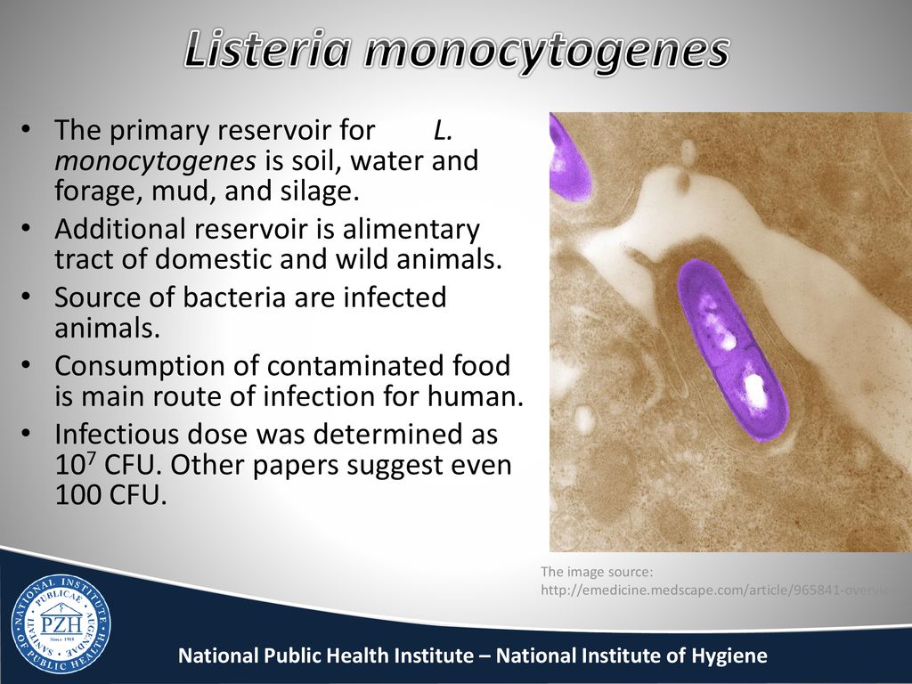 Листерия моноцитогенес. Листерии презентация. Листерии таксономия. Listeria monocytogenes таксономия.