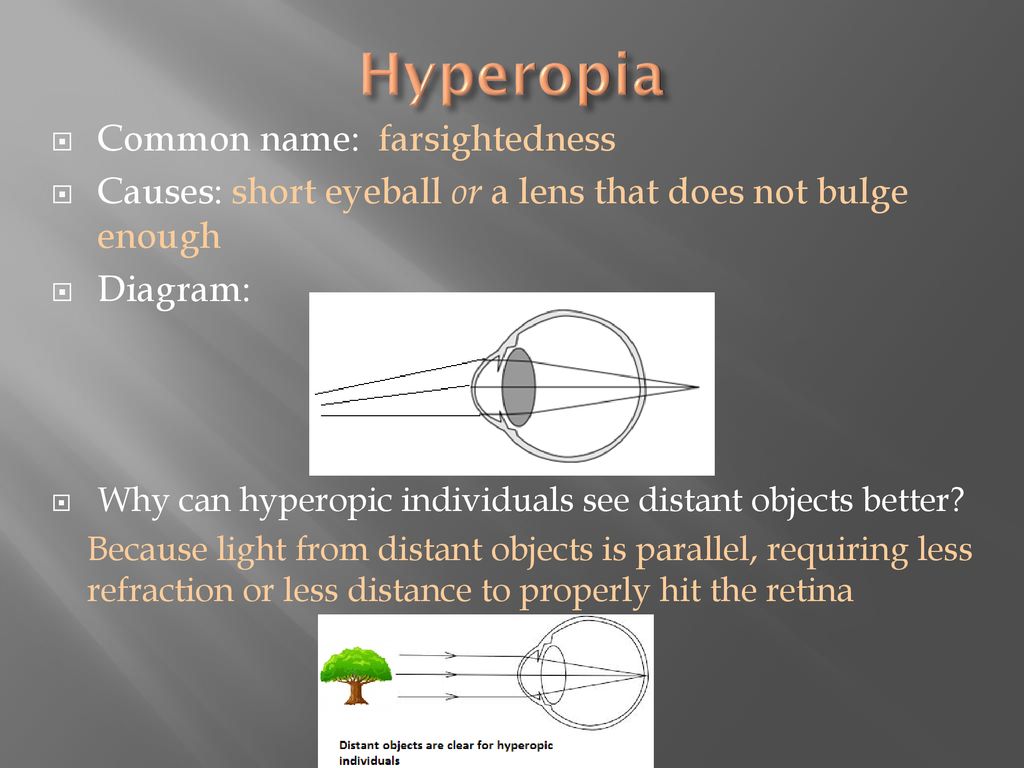 myopia hyperopia and astigmatism ppt