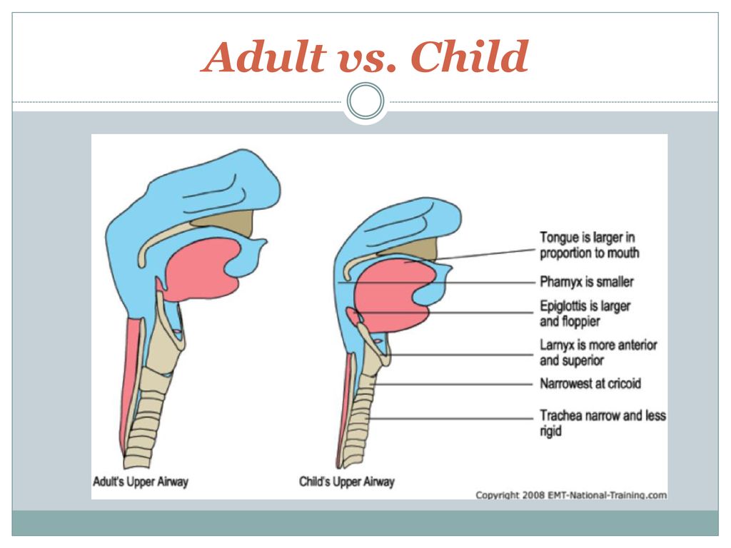 Airway Management In Pediatric Patients Ppt Download