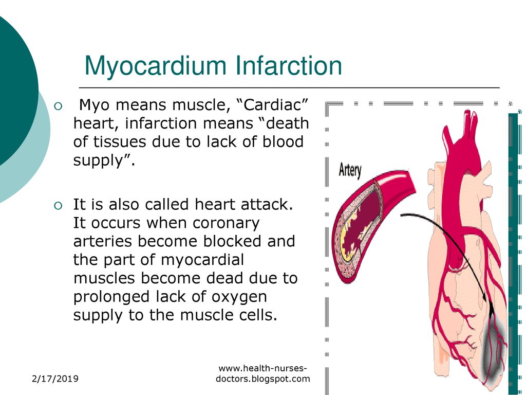 CORONARY ARTERY DISEASE - ppt download