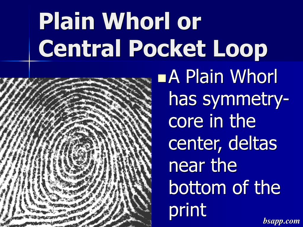 Plain Whorl or Central Pocket Loop