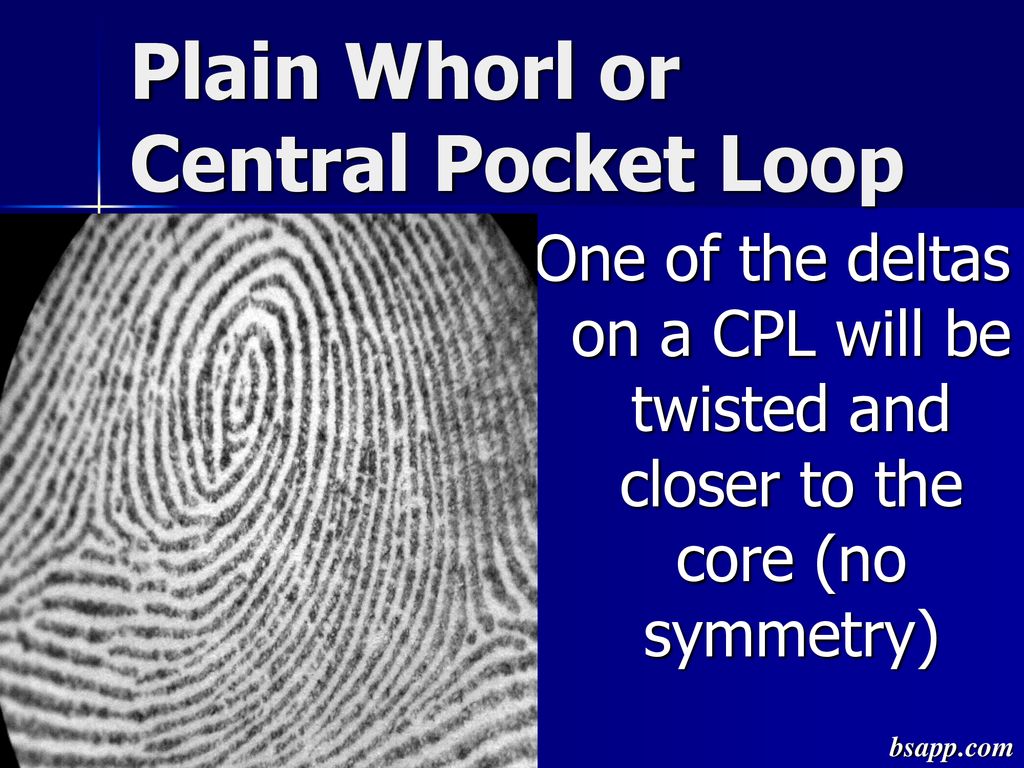 Plain Whorl or Central Pocket Loop