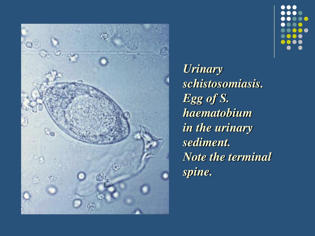 schistosomiasis urine cum se tratează condilomul la bărbați