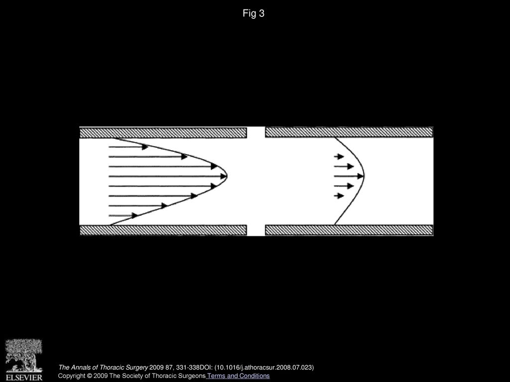 Fig 3 Transverse section of a vessel showing typical velocity profiles for (left) high-wall shear rate and (right) low-wall shear rate.