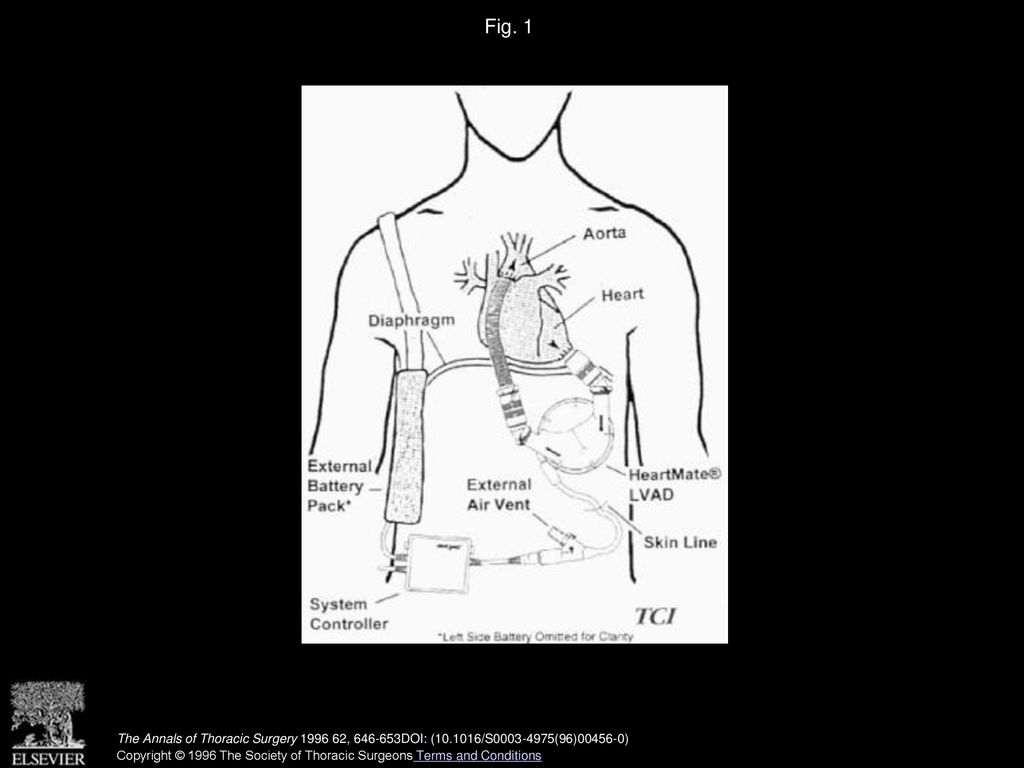 Katharine A. Catanese, MSN, Daniel J. Goldstein, MD, Deborah L - ppt ...