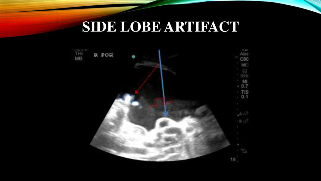 Point Of Care Ultrasound Ppt Download