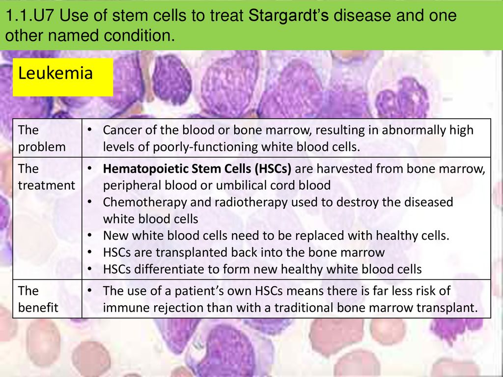 Stem Cells Essential Idea The Evolution Of Multicellular Organisms Allowed Cell Specialization And Cell Replacement The Background Image Shows Totipotent Ppt Download