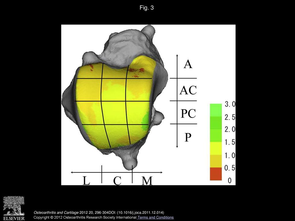 Three-dimensional Distribution Of Articular Cartilage Thickness In The ...