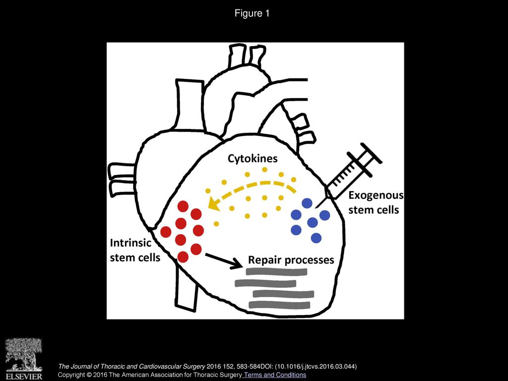 Figure 1 Synergistic effect of intrinsic stem cells and implanted cells on cardiac repair.