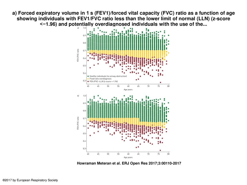 a) Forced expiratory volume in 1 s (FEV1)/forced vital capacity (FVC) ratio as a function of age showing individuals with FEV1/FVC ratio less than the lower limit of normal (LLN) (z-score <−1.96) and potentially overdiagnosed individuals with the use of the...