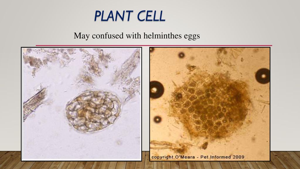 May confused with helminthes eggs
