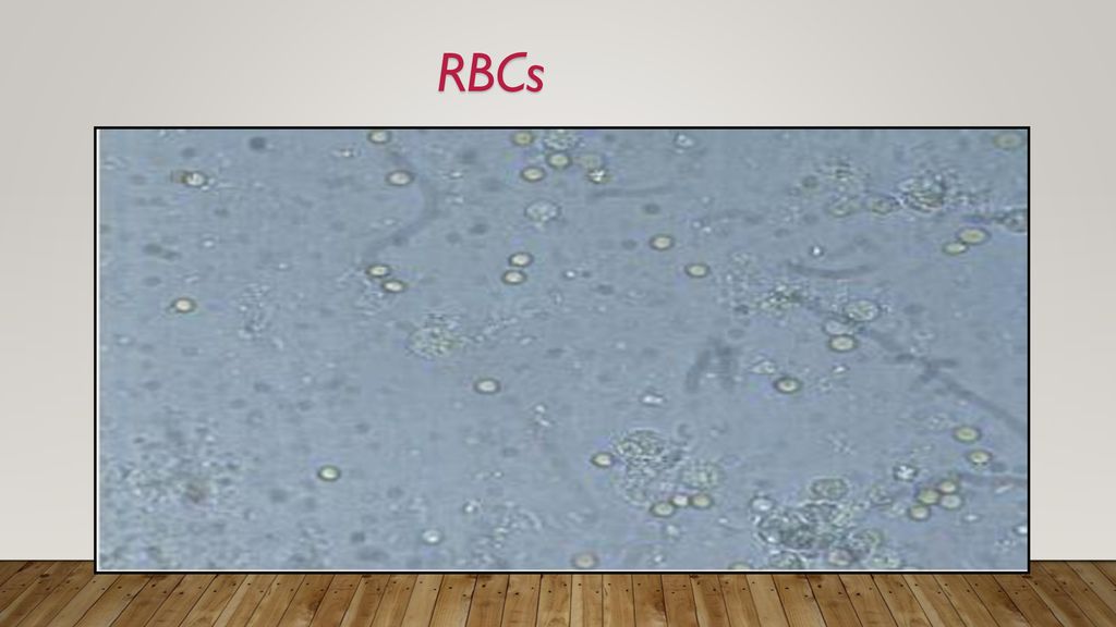 RBCs With fine adjustment (bright)