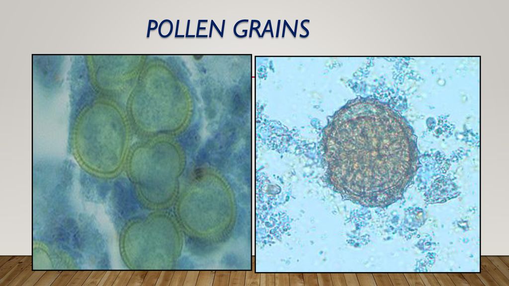 Pollen grains Both Pollen greens as lobed and like helminths egg but the egg of heminths yellow to brown to golden yellow.