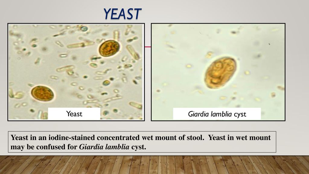 Yeast Yeast Giardia lamblia cyst