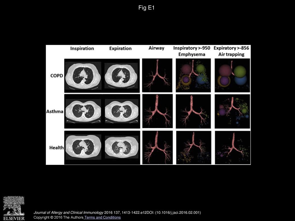 Relationship between lung function and quantitative computed ...