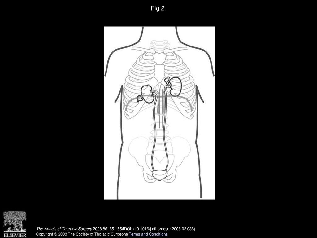 Fig 2 Drawing demonstrates patient s anatomy.