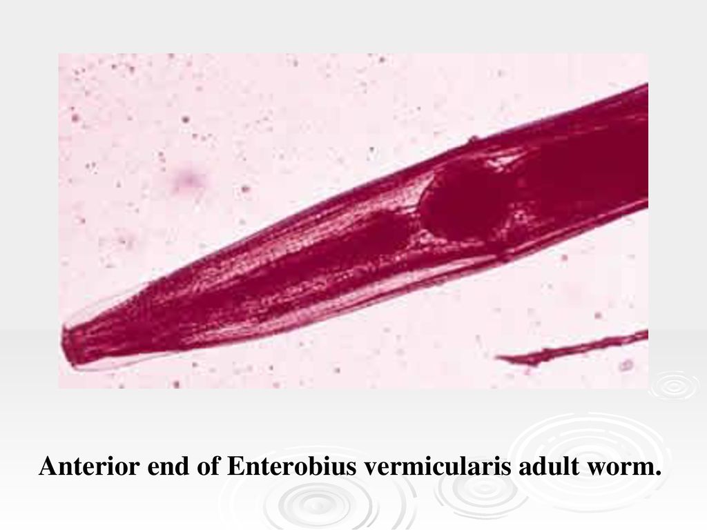 Enterobiasis pinworm tünetek kezelése, Az enterobius vermicularis volt ist das
