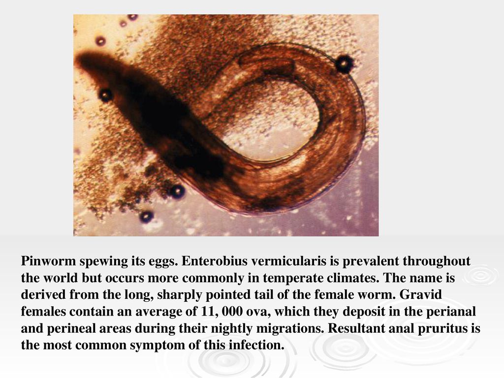 A pinworms következményei az emberekre - Diagnostics 