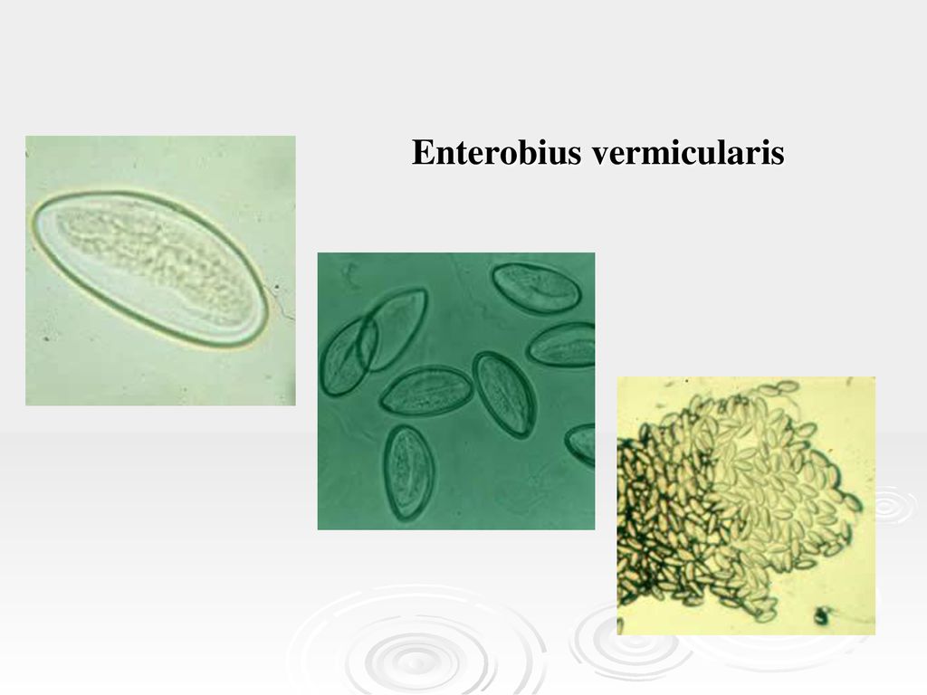 enterobius vermicularis klinikai eset