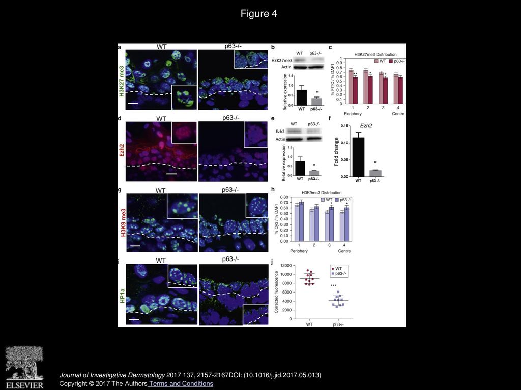 H3k9me3 Heterochromatin Loss At Protein Coding Genes Enables